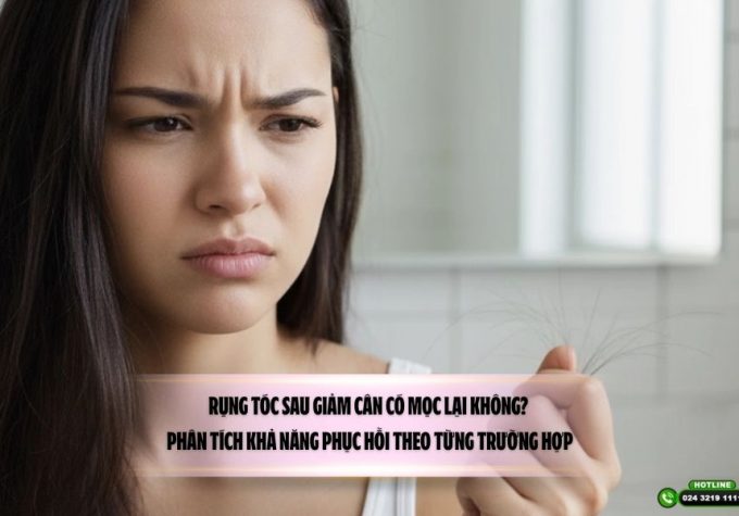 Rụng tóc sau giảm cân có mọc lại không? Phân tích khả năng phục hồi theo từng trường hợp