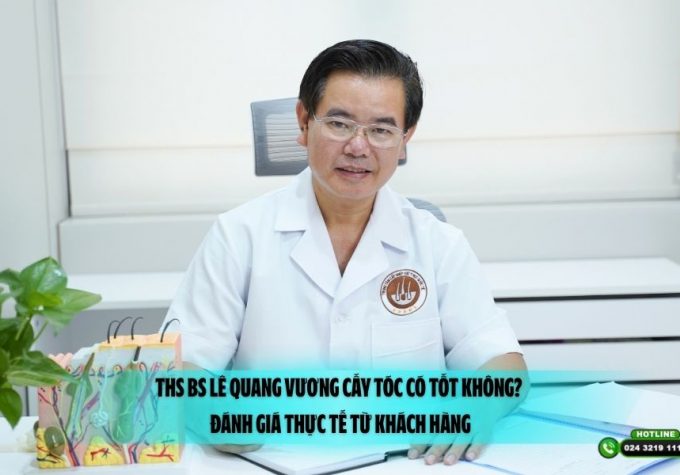 ThS BS Lê Quang Vương cấy tóc có tốt không? Đánh giá thực tế từ khách hàng