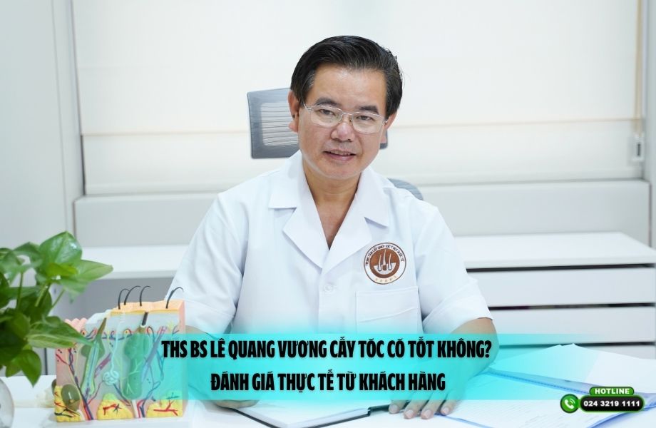 ThS BS Lê Quang Vương cấy tóc có tốt không? Đánh giá thực tế từ khách hàng