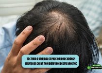 Tóc thưa ở đỉnh đầu có phục hồi được không? Chuyên gia chỉ ra thời điểm vàng để cứu nang tóc
