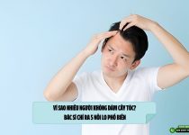 Vì sao nhiều người không dám cấy tóc? Bác sĩ chỉ ra 5 nỗi lo phổ biến