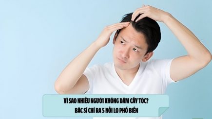 Vì sao nhiều người không dám cấy tóc? Bác sĩ chỉ ra 5 nỗi lo phổ biến