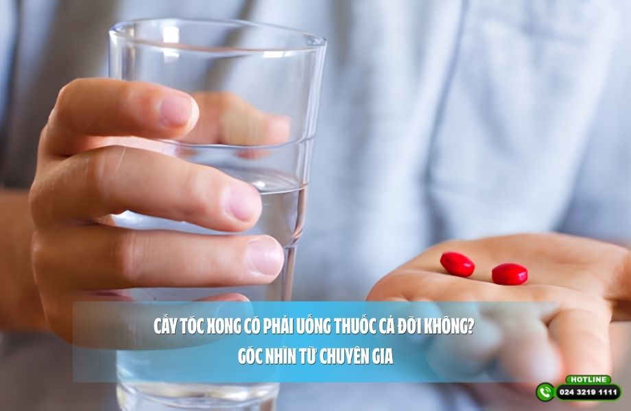 Cấy tóc xong có phải uống thuốc cả đời không? Góc nhìn từ chuyên gia