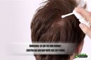 Minoxidil có gây vô sinh không? Chuyên gia giải đáp dưới góc độ y khoa