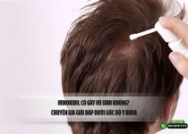 Minoxidil có gây vô sinh không? Chuyên gia giải đáp dưới góc độ y khoa