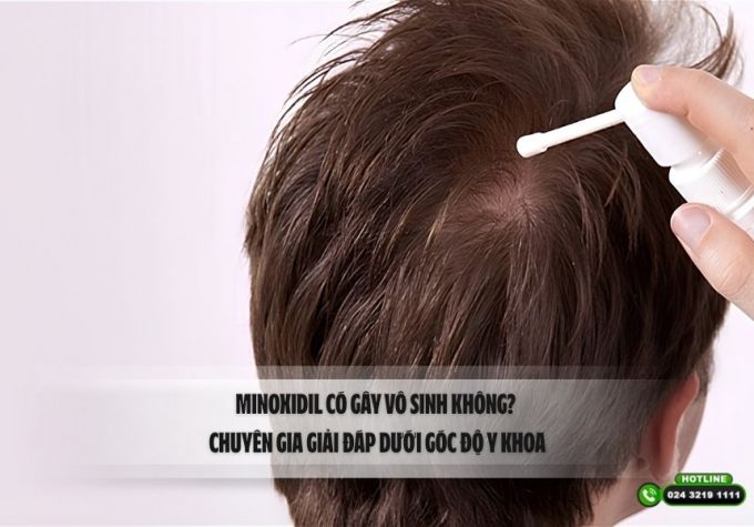 Minoxidil có gây vô sinh không? Chuyên gia giải đáp dưới góc độ y khoa