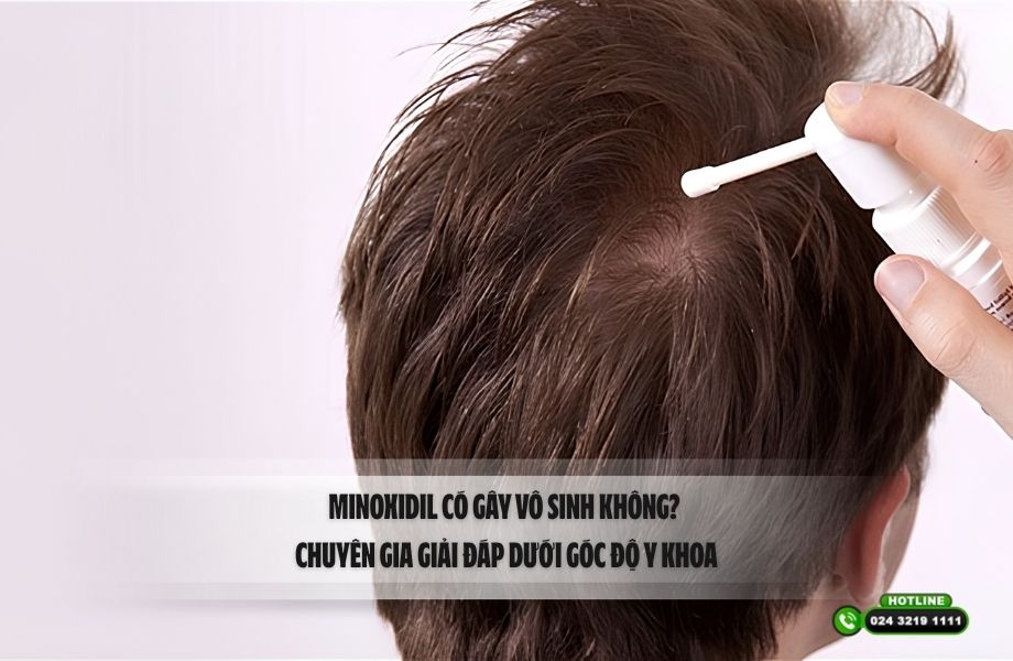 Minoxidil có gây vô sinh không? Chuyên gia giải đáp dưới góc độ y khoa