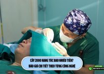 Cấy 2000 nang tóc bao nhiêu tiền? Báo giá chi tiết theo từng công nghệ