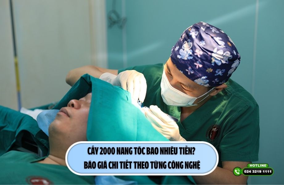 Cấy 2000 nang tóc bao nhiêu tiền? Báo giá chi tiết theo từng công nghệ