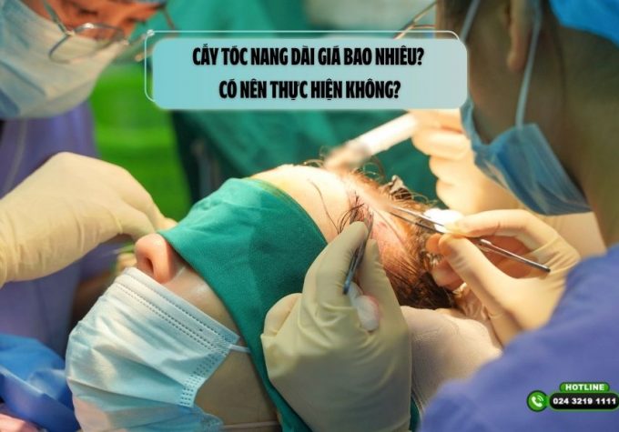 Cấy tóc nang dài giá bao nhiêu? Có nên thực hiện không?