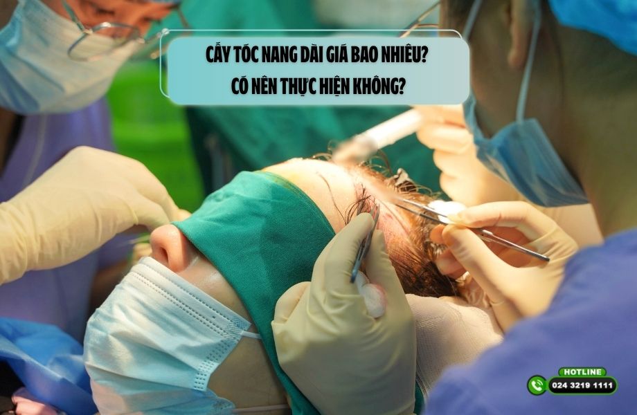 Cấy tóc nang dài giá bao nhiêu? Có nên thực hiện không?