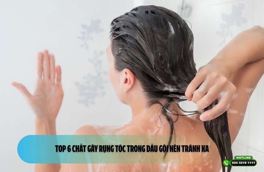 Top 6 chất gây rụng tóc trong dầu gội nên tránh xa