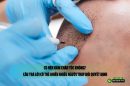 Có nên xăm chân tóc không? Câu trả lời có thể khiến nhiều người thay đổi quyết định