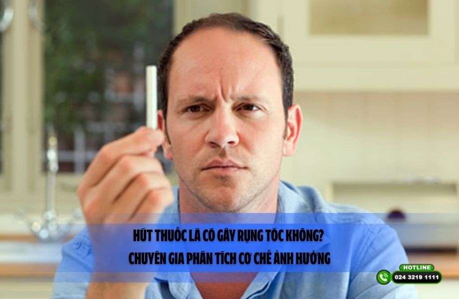 Hút thuốc lá có gây rụng tóc không? Chuyên gia phân tích cơ chế ảnh hưởng