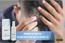 Minoxidil gây rụng tóc: Tác dụng phụ hay dấu hiệu tóc sắp mọc lại?