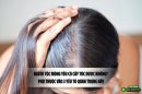 Người tóc mỏng yếu có cấy tóc được không? Phụ thuộc vào 3 yếu tố quan trọng này