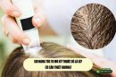 Soi nang tóc vi mô kỹ thuật số là gì? Có cần thiết không?