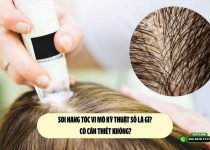 Soi nang tóc vi mô kỹ thuật số là gì? Có cần thiết không?