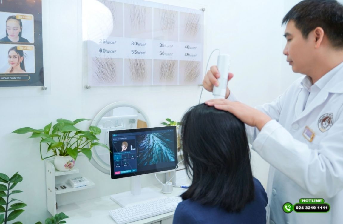 Xạ trị có gây rụng tóc không? Hướng dẫn cách phục hồi tóc sau điều trị