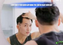 Cảnh báo 9 thói quen gây rụng tóc cần bỏ ngay hôm nay