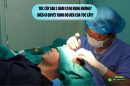 Tóc cấy sau 2 năm có bị rụng không? Điều gì quyết định độ bền của tóc cấy?