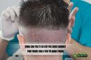 Vùng cho tóc ít có cấy tóc được không? Phụ thuộc vào 3 yếu tố quan trọng