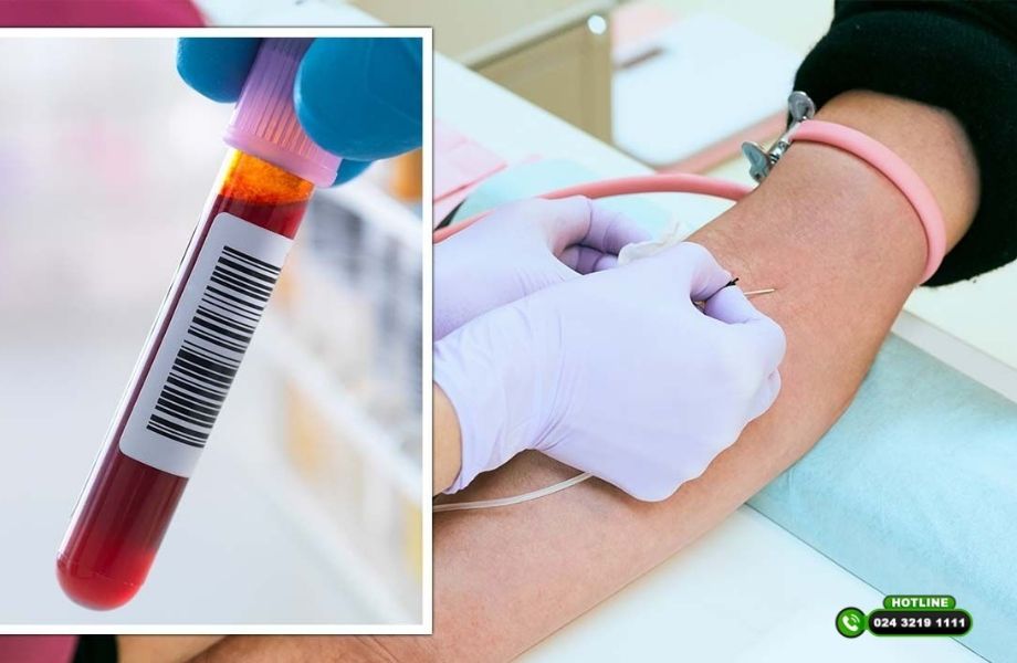 Vì sao cần xét nghiệm rụng tóc trước khi cấy tóc?