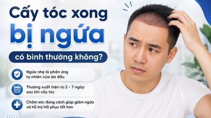 Cấy tóc xong bị ngứa có bình thường không