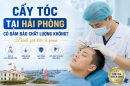 Cấy tóc tại Hải Phòng có đảm bảo chất lượng không? Đánh giá khách quan