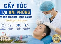 Cấy tóc tại Hải Phòng có đảm bảo chất lượng không? Đánh giá khách quan