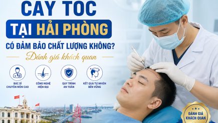 Cấy tóc tại Hải Phòng có đảm bảo chất lượng không? Đánh giá khách quan