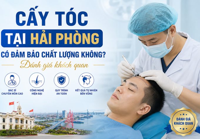 Cấy tóc tại Hải Phòng có đảm bảo chất lượng không? Đánh giá khách quan