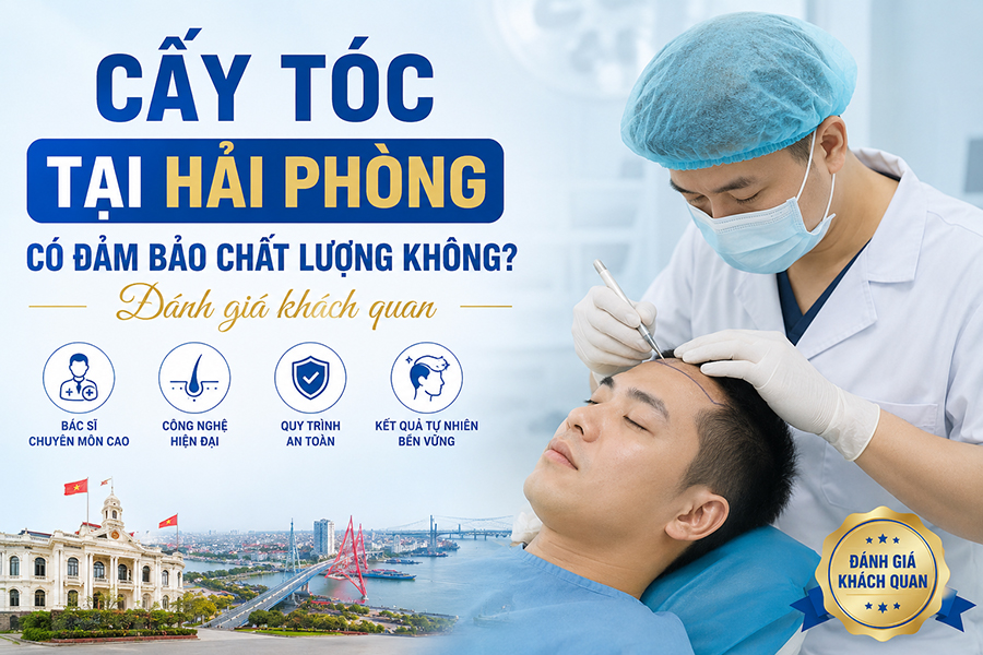 Cấy tóc tại Hải Phòng có đảm bảo chất lượng không? Đánh giá khách quan