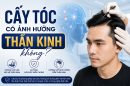 [Giải Đáp]: Cấy tóc có ảnh hưởng thần kinh không?