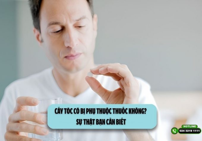 Cấy tóc có bị phụ thuộc thuốc không? Sự thật bạn cần biết