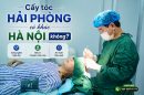 Cấy tóc Hải Phòng có khác Hà Nội không? So sánh khách quan