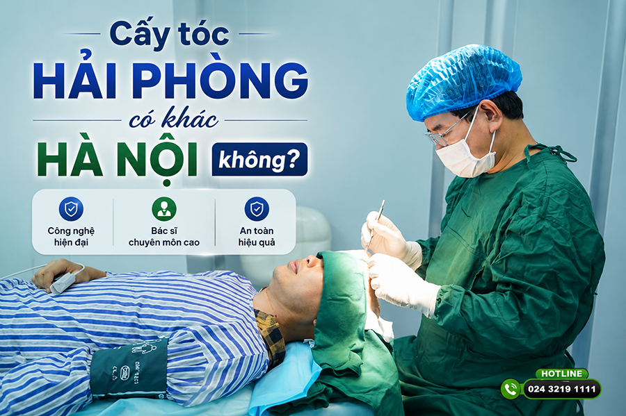 Cấy tóc Hải Phòng có khác Hà Nội không? So sánh khách quan