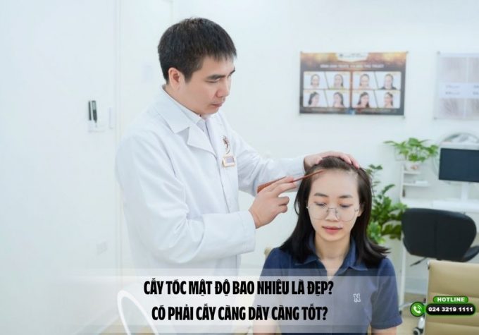 Cấy tóc mật độ bao nhiêu là đẹp? Có phải cấy càng dày càng tốt?