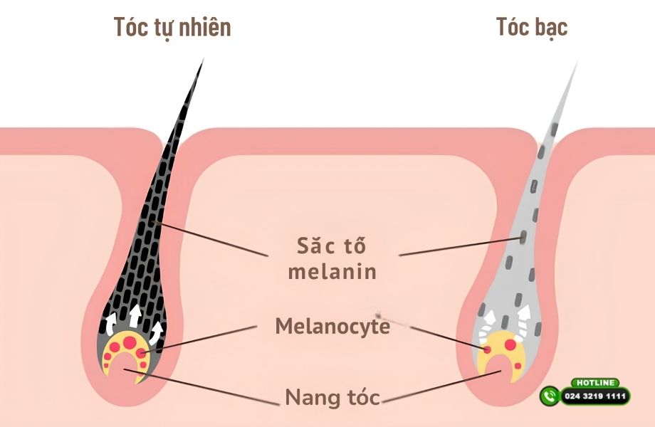Tóc cấy có bạc như tóc thật không? Bác sĩ giải đáp dưới góc độ y khoa
