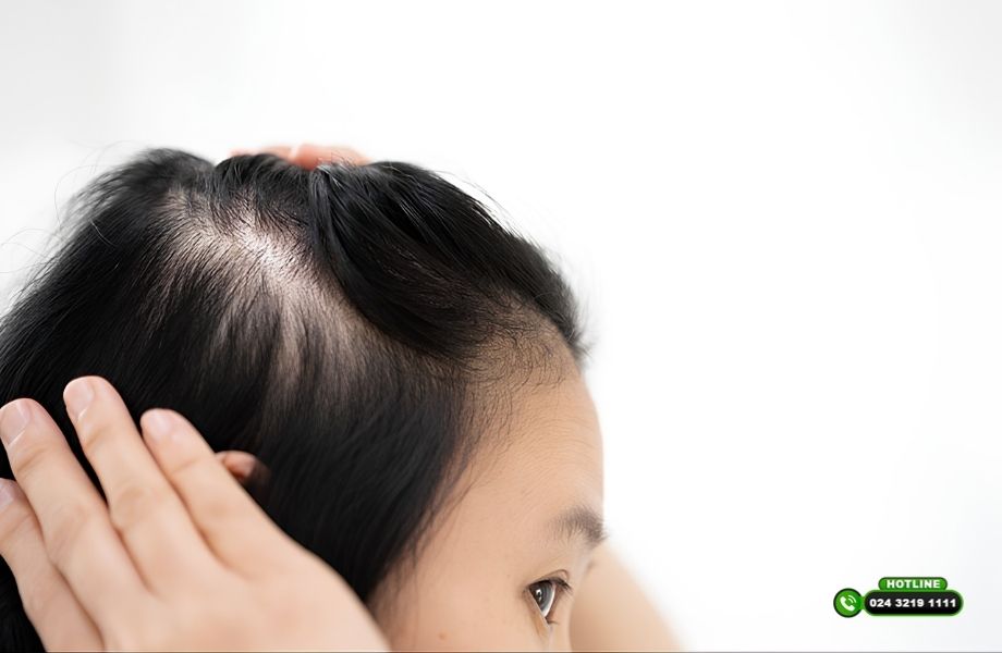 Mơ rụng tóc là điềm gì? Giải mã dưới góc nhìn khoa học và quan niệm dân gian