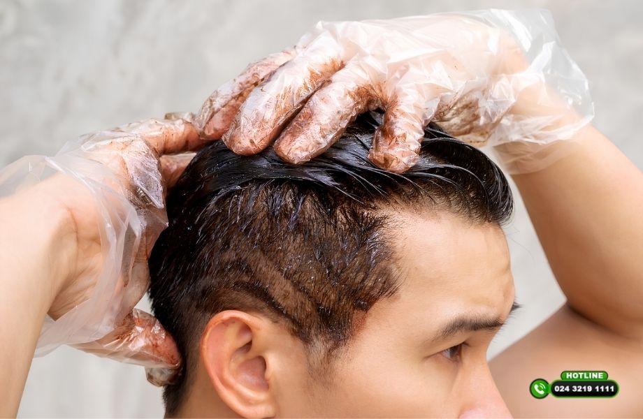 Tóc cấy có bạc như tóc thật không? Bác sĩ giải đáp dưới góc độ y khoa
