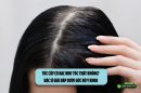 Tóc cấy có bạc như tóc thật không? Bác sĩ giải đáp dưới góc độ y khoa