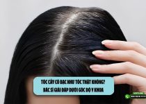 Tóc cấy có bạc như tóc thật không? Bác sĩ giải đáp dưới góc độ y khoa