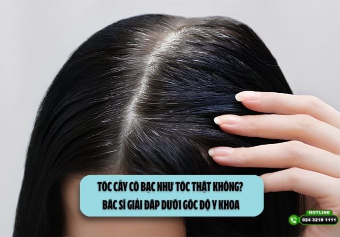 Tóc cấy có bạc như tóc thật không? Bác sĩ giải đáp dưới góc độ y khoa