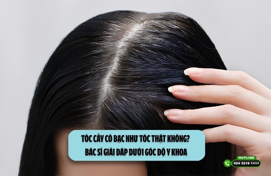 Tóc cấy có bạc như tóc thật không? Bác sĩ giải đáp dưới góc độ y khoa