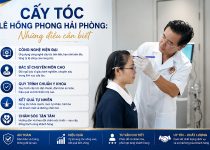 Cấy tóc Lê Hồng Phong Hải Phòng