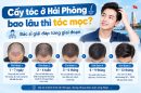 Cấy tóc ở Hải Phòng bao lâu thì tóc mọc? Bác sĩ giải đáp từng giai đoạn