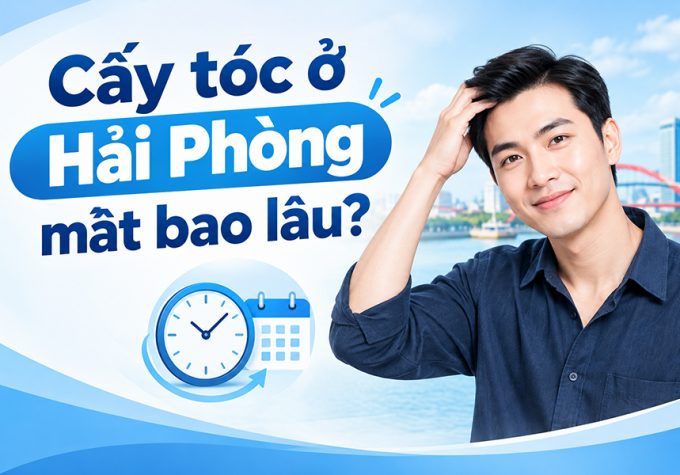 Cấy tóc ở Hải Phòng mất bao lâu? Thời gian thực hiện và hồi phục