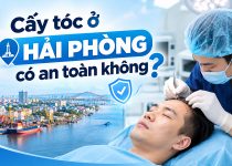 Cấy tóc ở Hải Phòng có an toàn không? 5 điều cần biết