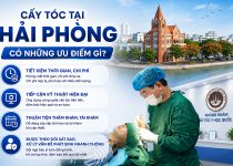 Cấy tóc tại Hải Phòng có những ưu điểm gì